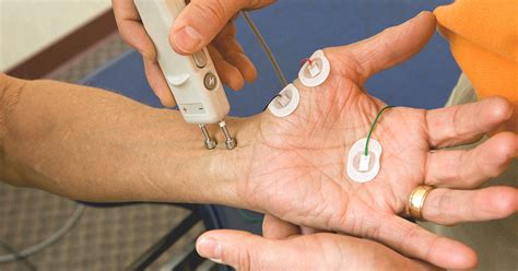 emg test shows nerve damage.